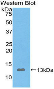 Polyclonal Antibody to Interleukin 8 (IL8)