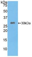 Polyclonal Antibody to Leptin Receptor (LEPR)