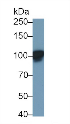 Polyclonal Antibody to Leptin Receptor (LEPR)