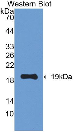 Polyclonal Antibody to Leptin Receptor (LEPR)