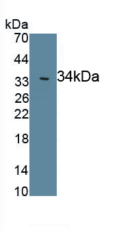 Polyclonal Antibody to Leptin (LEP)