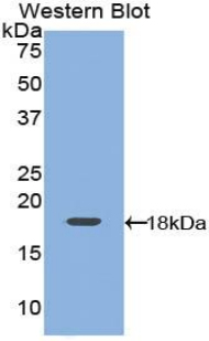 Polyclonal Antibody to Leptin (LEP)