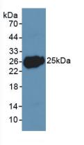 Polyclonal Antibody to Leukemia Inhibitory Factor (LIF)