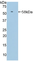 Polyclonal Antibody to Selectin, Leukocyte (SELL)