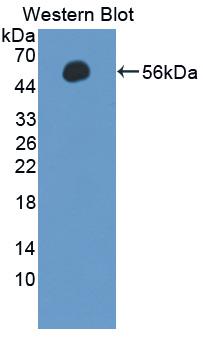 Polyclonal Antibody to Selectin, Leukocyte (SELL)