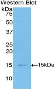 Polyclonal Antibody to Monocyte Chemotactic Protein 1 (MCP1)