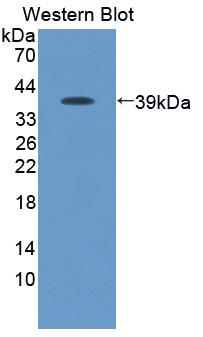 Polyclonal Antibody to Macrophage Inflammatory Protein 3 Beta (MIP3b)