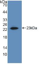 Polyclonal Antibody to Matrix Metalloproteinase 1 (MMP1)