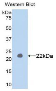 Biotin-Linked Polyclonal Antibody to Matrix Metalloproteinase 1 (MMP1)