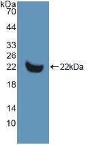 Polyclonal Antibody to Matrix Metalloproteinase 13 (MMP13)