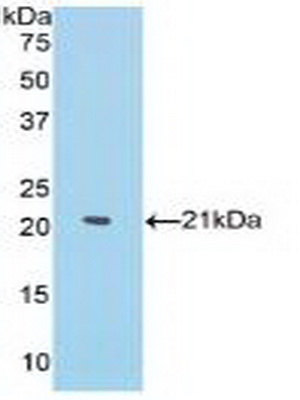 Polyclonal Antibody to Matrix Metalloproteinase 13 (MMP13)