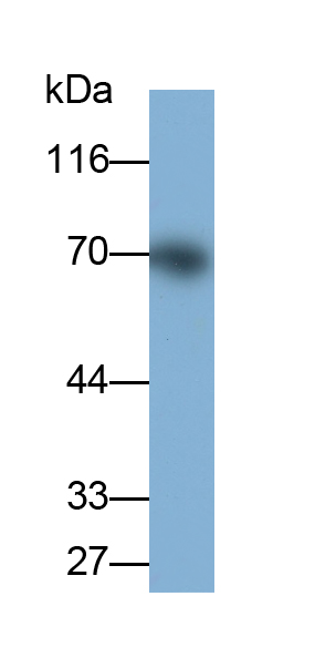 Polyclonal Antibody to Matrix Metalloproteinase 13 (MMP13)