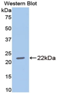 Polyclonal Antibody to Matrix Metalloproteinase 13 (MMP13)