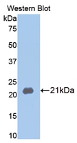 Polyclonal Antibody to Matrix Metalloproteinase 13 (MMP13)