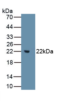 Polyclonal Antibody to Matrix Metalloproteinase 3 (MMP3)