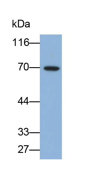 Polyclonal Antibody to Matrix Metalloproteinase 8 (MMP8)