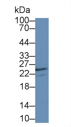 Polyclonal Antibody to Nerve Growth Factor (NGF)