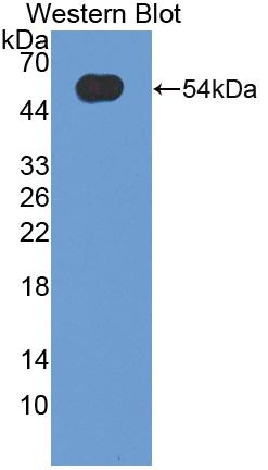 Polyclonal Antibody to Oncostatin M (OSM)