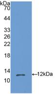 Polyclonal Antibody to Oncostatin M (OSM)