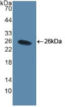 Polyclonal Antibody to Cluster Of Differentiation 40 Ligand (CD40L)