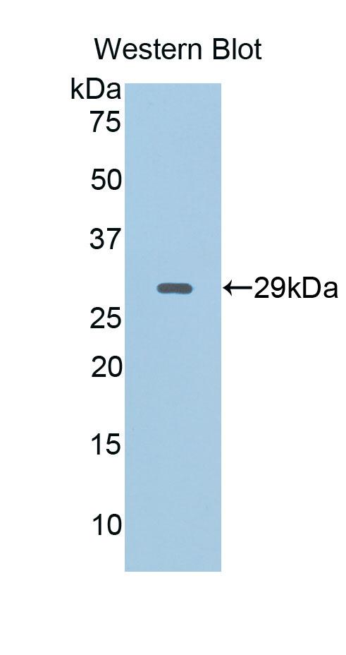 Polyclonal Antibody to Cluster Of Differentiation 40 Ligand (CD40L)