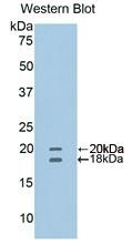 Polyclonal Antibody to Cluster Of Differentiation 40 Ligand (CD40L)