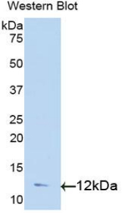 Polyclonal Antibody to Transforming Growth Factor Alpha (TGFa)