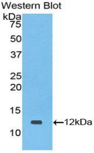 Polyclonal Antibody to Transforming Growth Factor Alpha (TGFa)