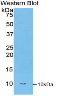 Polyclonal Antibody to Transforming Growth Factor Alpha (TGFa)