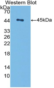 Polyclonal Antibody to Transforming Growth Factor Beta 1 (TGFb1)