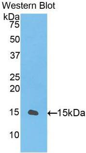 FITC-Linked Polyclonal Antibody to Transforming Growth Factor Beta 1 (TGFb1)