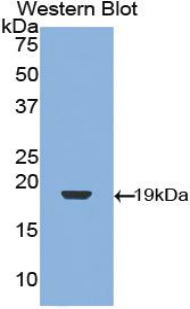 Polyclonal Antibody to Transforming Growth Factor Beta 1 (<b>TGFb1</b>)