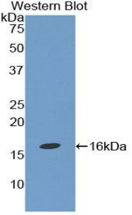 Polyclonal Antibody to Transforming Growth Factor Beta 1 (TGFb1)