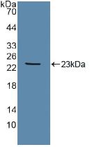 Polyclonal Antibody to TEK Tyrosine Kinase, Endothelial (Tie2)