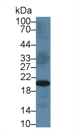 Polyclonal Antibody to Tissue Inhibitors Of Metalloproteinase 3 (TIMP3)