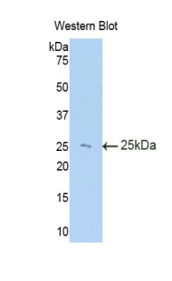 Polyclonal Antibody to Tissue Inhibitors Of Metalloproteinase 3 (TIMP3)