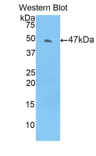 Polyclonal Antibody to Tissue Inhibitors Of Metalloproteinase 4 (TIMP4)