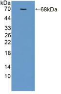 Polyclonal Antibody to Adiponectin Receptor 2 (ADIPOR2)