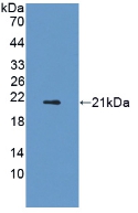 Polyclonal Antibody to Adiponectin Receptor 2 (ADIPOR2)