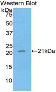 Polyclonal Antibody to Tumor Necrosis Factor Alpha (TNFa)