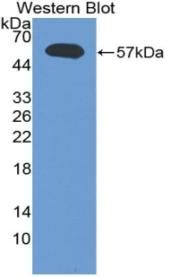 Polyclonal Antibody to Tumor Necrosis Factor Beta (TNFb)