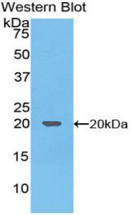 Polyclonal Antibody to Tumor Necrosis Factor Related Apoptosis Inducing Ligand (TRAIL)