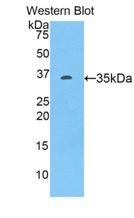 Polyclonal Antibody to Tumor Necrosis Factor Related Apoptosis Inducing Ligand (TRAIL)