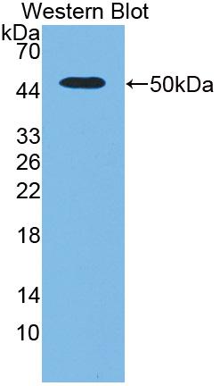 Polyclonal Antibody to Plasminogen Activator, Urokinase (uPA)