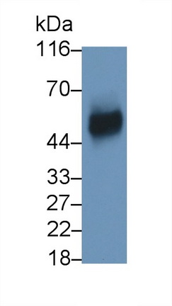 Polyclonal Antibody to Plasminogen Activator, Urokinase Receptor (uPAR)