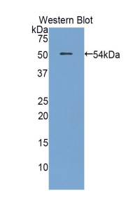 FITC-Linked Polyclonal Antibody to Plasminogen Activator, Urokinase Receptor (uPAR)