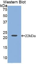 Polyclonal Antibody to Vascular Endothelial Growth Factor A (VEGFA)