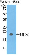 Polyclonal Antibody to Carcinoembryonic Antigen (CEA)