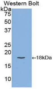 Polyclonal Antibody to Carcinoembryonic Antigen (CEA)