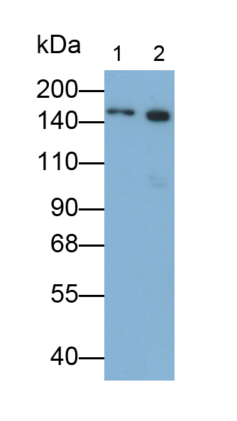 Polyclonal Antibody to Carcinoembryonic Antigen (CEA)